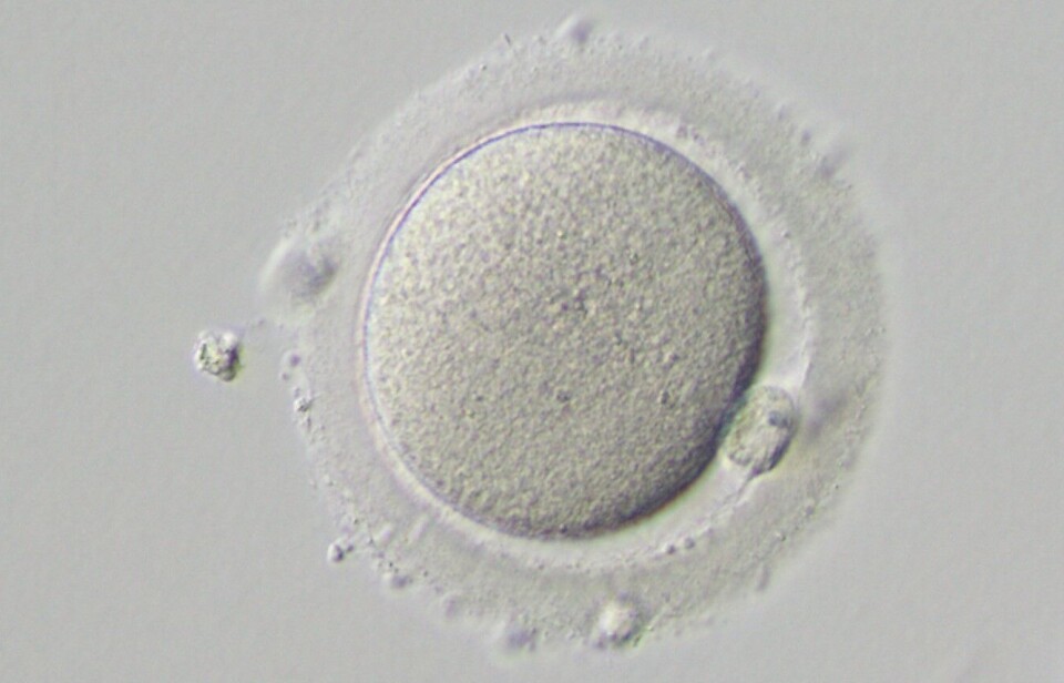 The image shows a human egg cell. During conception, the egg cell merges with a sperm cell to form a single cell, a fertilised egg.