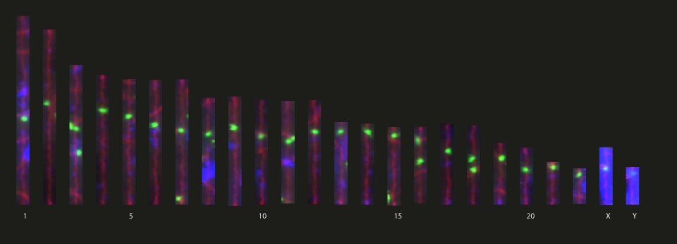 This image shows the 22 chromosomes plus X and Y, coloured with fluorescence and observed under a microscope.