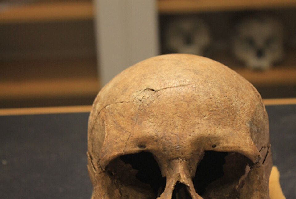 This skull, belonging to a woman from a burial mound in what is now Ringsaker, shows evidence of a blunt force injury that happened just prior to or during the woman's death. The blow caused a semi-circular depression in the skull with radiating cracks.