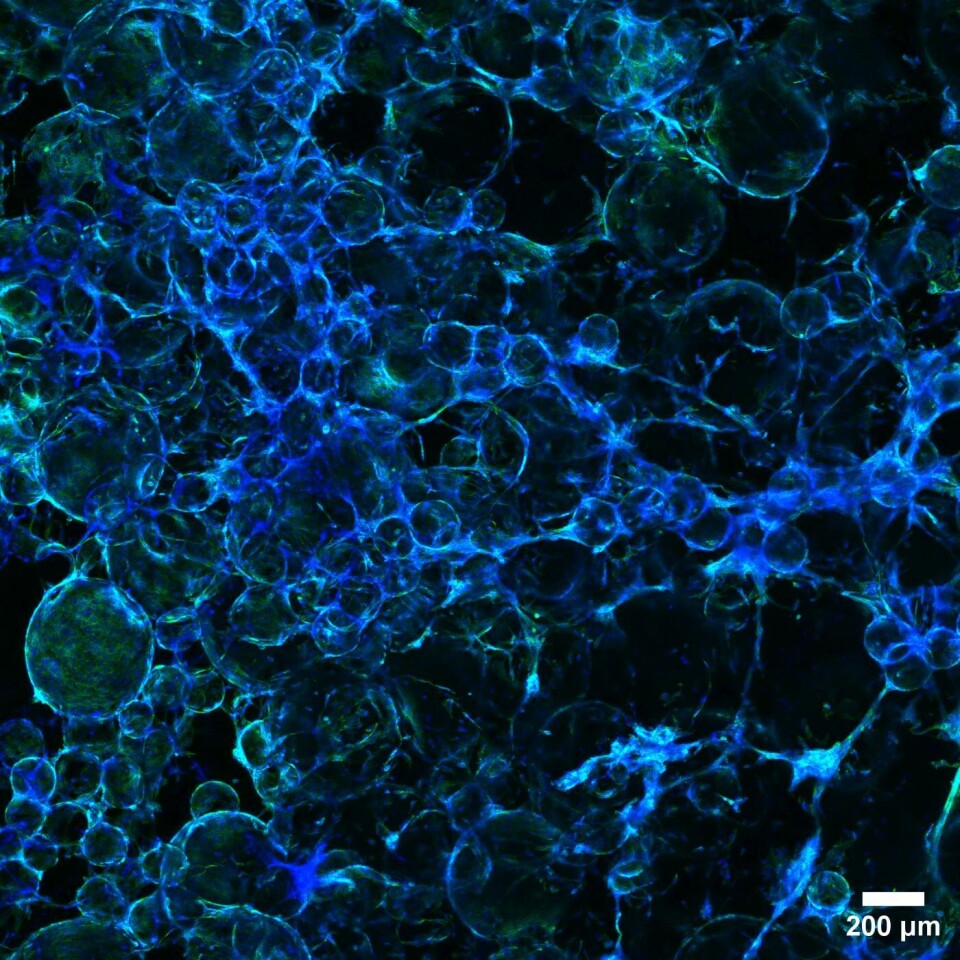 This is what lab-grown meat looks like through a microscope.