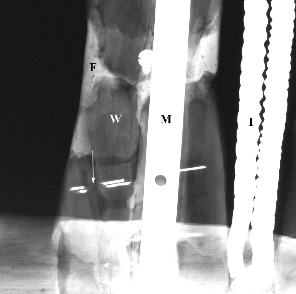 X-ray image of part of Gustafson's sled. The arrow points to a rusted rivet.