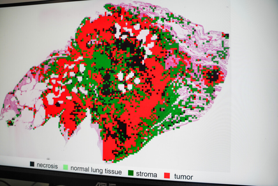 The image shows how the system distinguishes between healthy, diseased, and dead lung tissue in a digital image. KI-bilde av lungevev