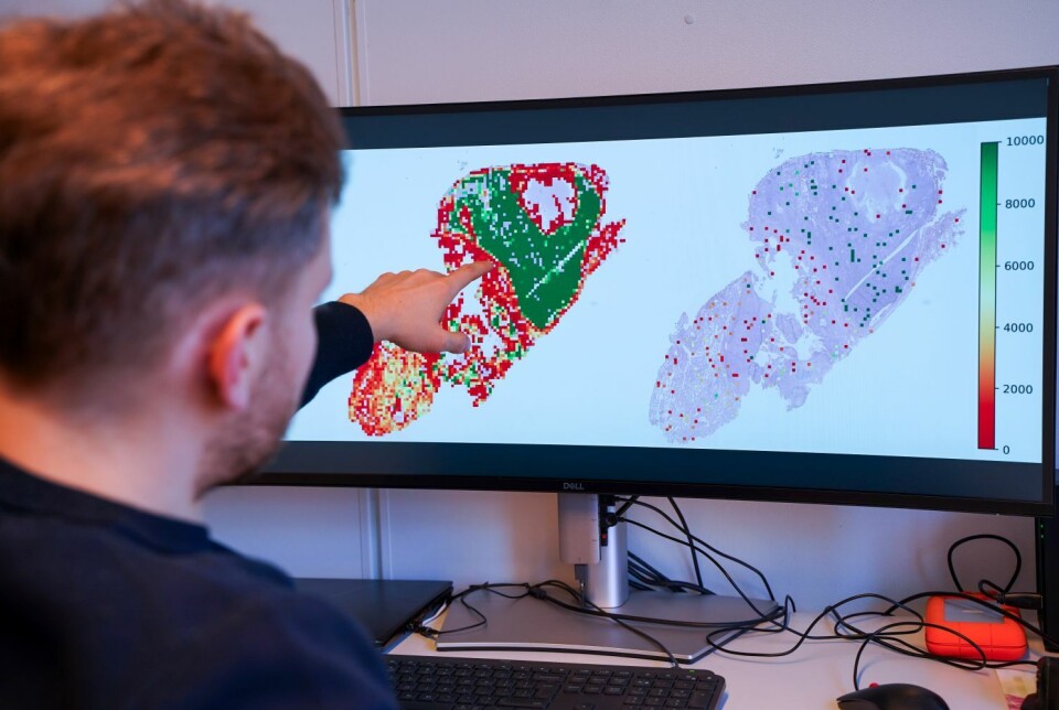 Researcher Nikita Shvetsov has developed an AI system that can contribute to less costly examinations and more personalised cancer treatment. Forsker foran PC