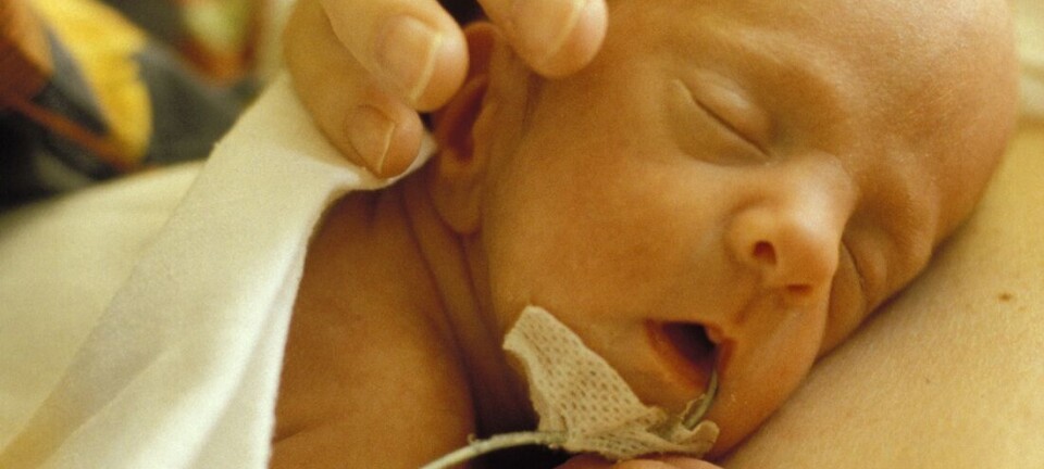 Premature babies should also have early skin-to-skin contact with their mothers