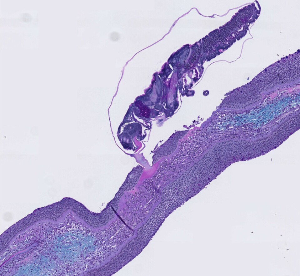 A sea louse attaches itself to a fish fin.