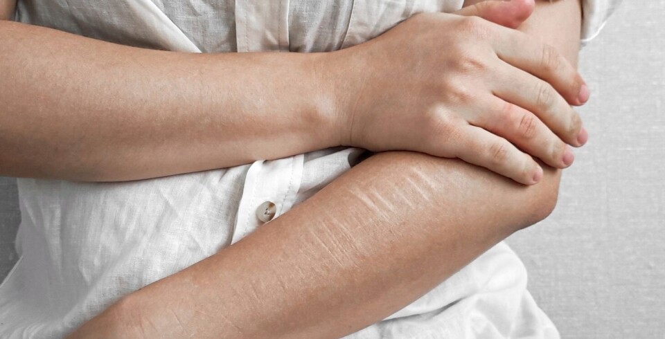 Norwegian study on self-harm: 'Concerning numbers'