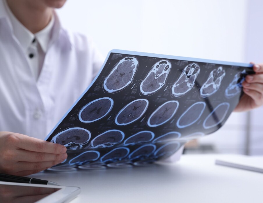 Researchers want to find out if viruses are behind diseases in the brain