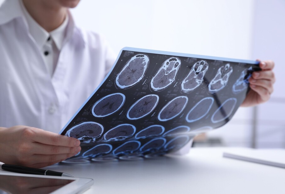Researchers want to find out if viruses are behind diseases in the brain