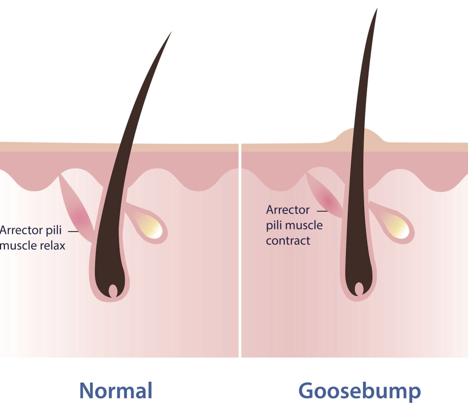 This image shows how the hair responds when the muscle contracts.