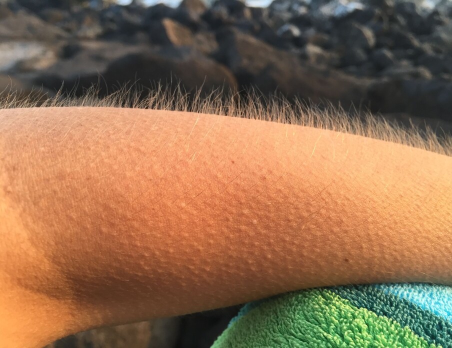 Why do we get goosebumps? 'A reminder that we're animals'