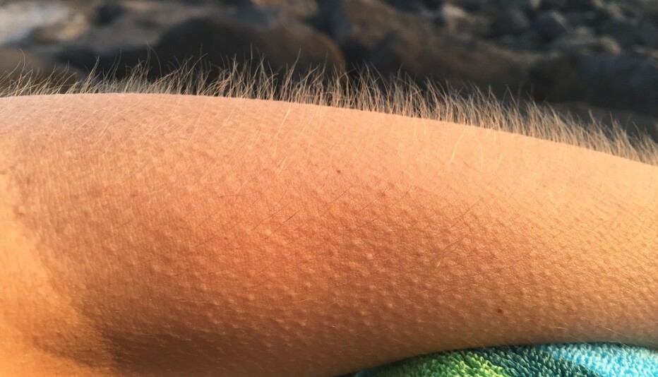 Why do we get goosebumps? 'A reminder that we're animals'