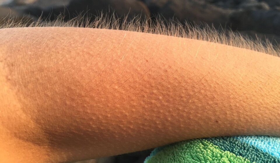 Where do goosebumps come from? 'It's a reminder that we're animals and that we once lived very differently,' says evolutionary biologist Kjetil Lysne Voje.