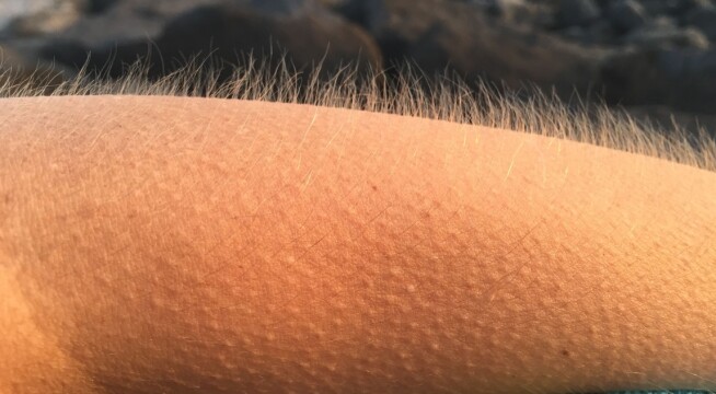 Why do we get goosebumps? 'A reminder that we're animals'