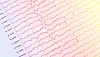 Close-up of EEG traces showing fluctuating brainwaves on paper.