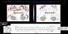 Graphic comparing brain activity patterns during negative and neutral film viewing.