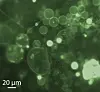 Green fluorescence micrograph showing rounded structures, fine fibres and a bright cluster at lower right.