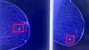 Two blue-toned mammogram images side by side, with red markings around small areas of breast tissue.