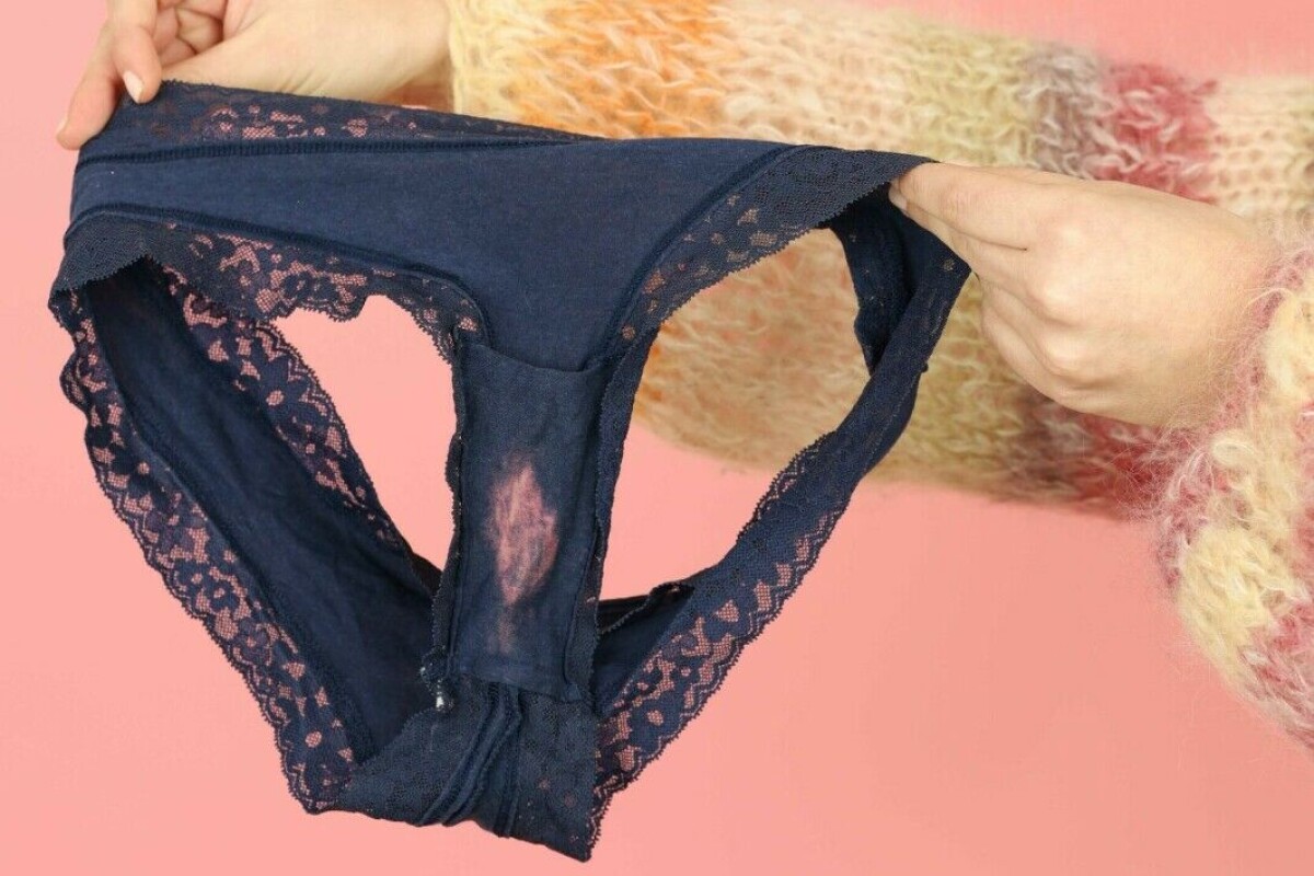 This bleached patch in your underwear is completely normal